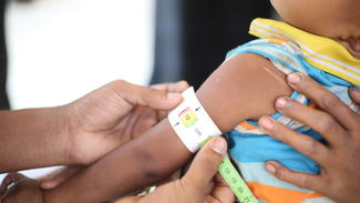Oberarm-Messung bei Kleinkind Herach in Bangladesch